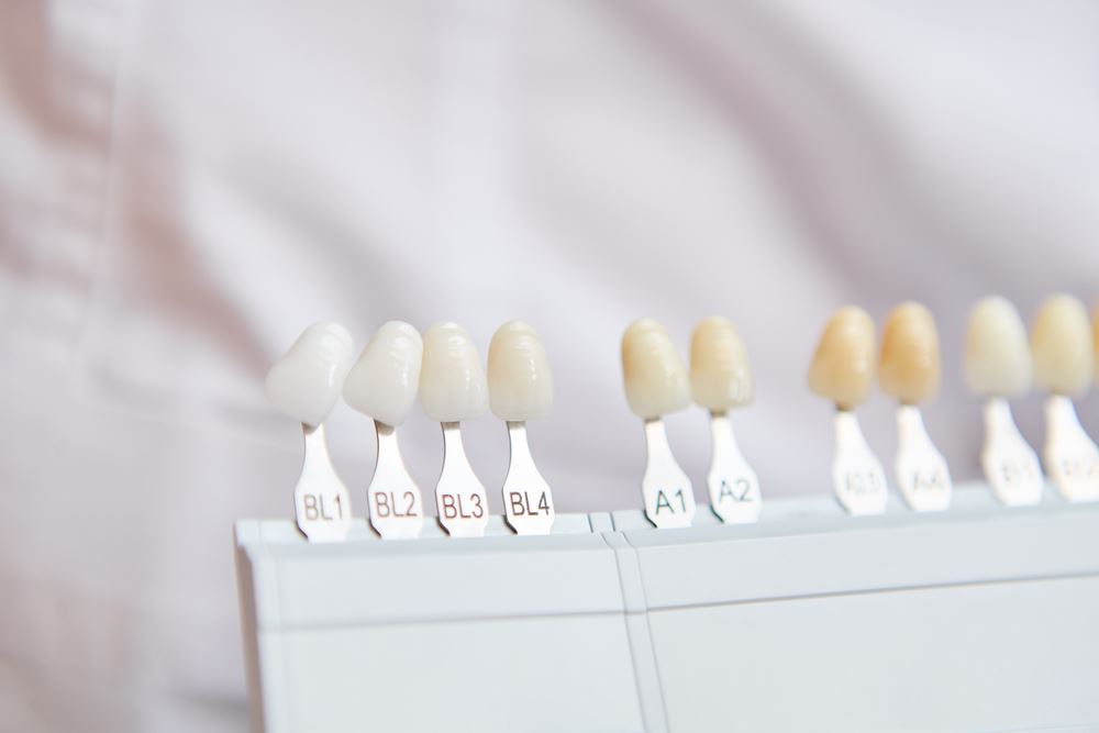 Dealing with Tooth Discoloration: Causes and Treatment Options